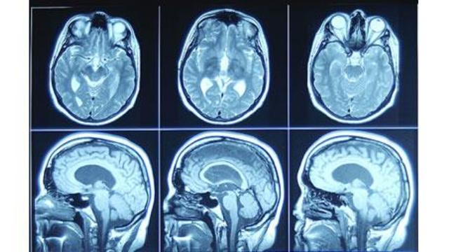 Image of The Journal: Debating Health Care Reform